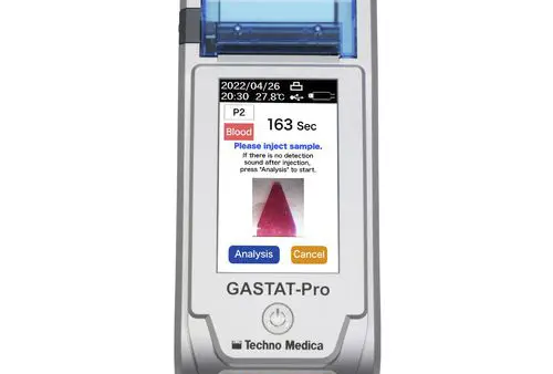 動脈血液ガス分析器を導入していきます